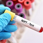 Laborröhrchen mit Blut und der Aufschrift NIPT Test